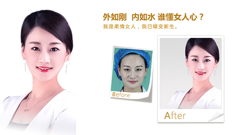 襄樊V脸、线雕隆鼻